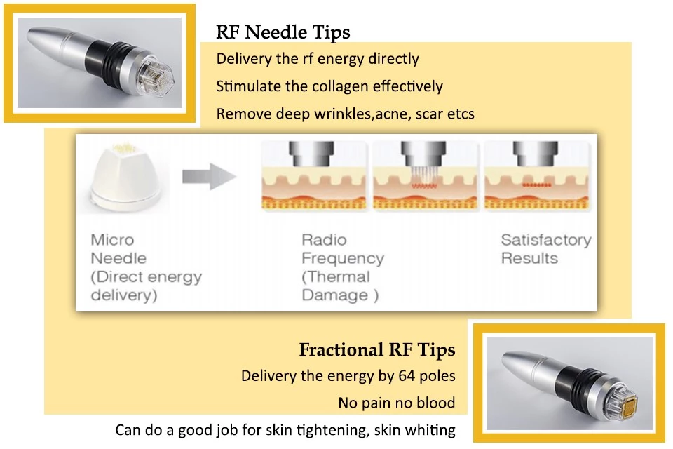 Best Permanent Skin Tightening Microneedle Fractional RF Machine Best Permanent Skin Tightening Microneedle Fractional RF Machine
